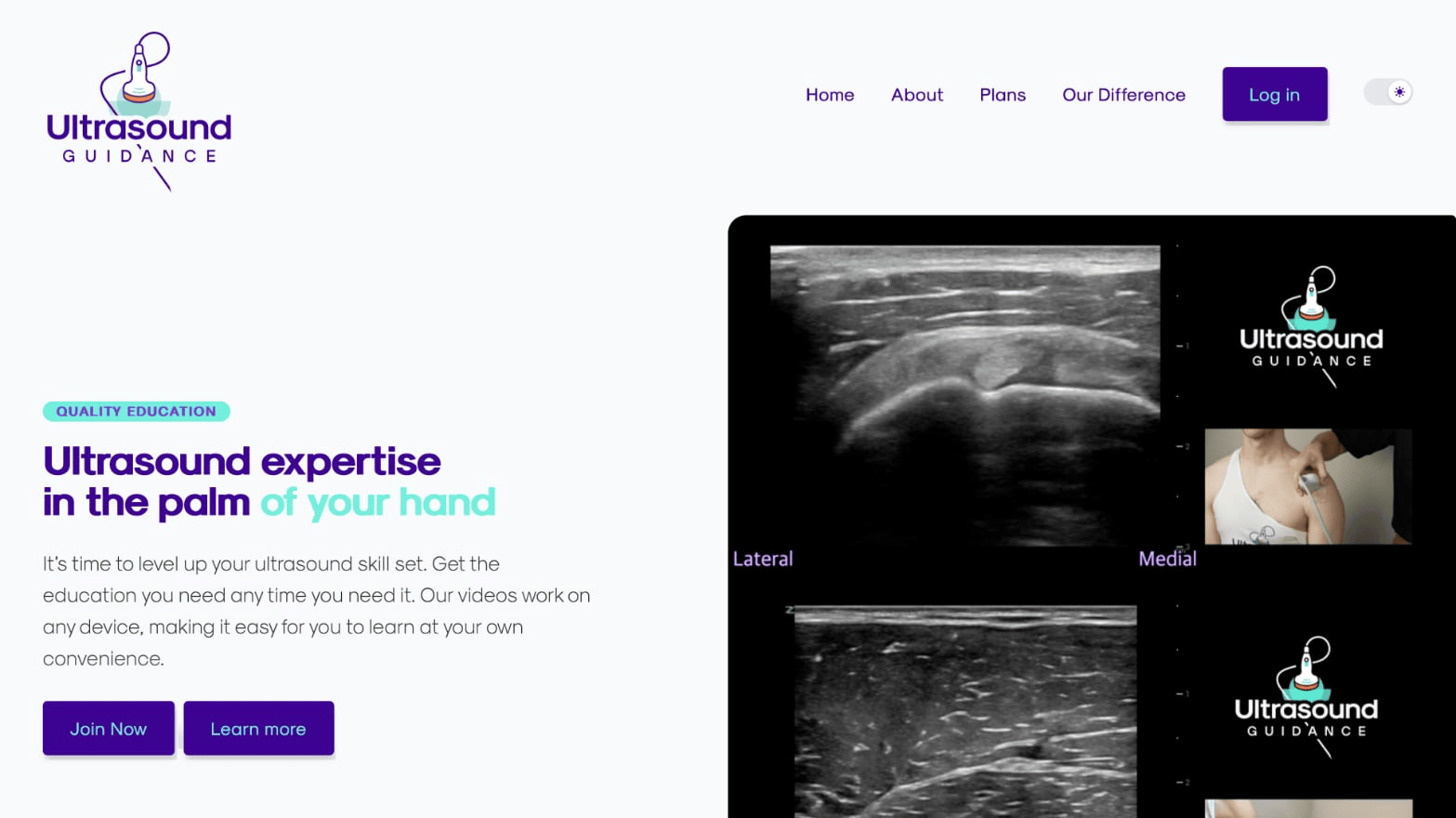 Screenshot of Ultrasound Guidance website, showing navigation, logo, hero image, and description